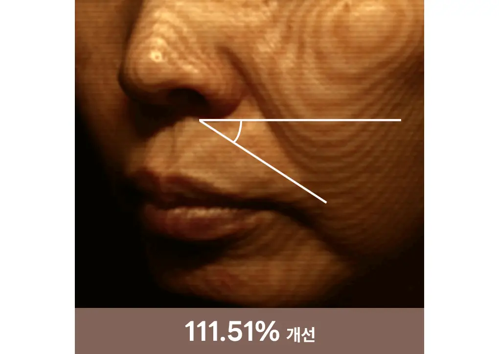 [탄력리프팅] 메디힐 레티놀 콜라겐 크림 윤곽 마스크 고보습 1매 상세페이지 19